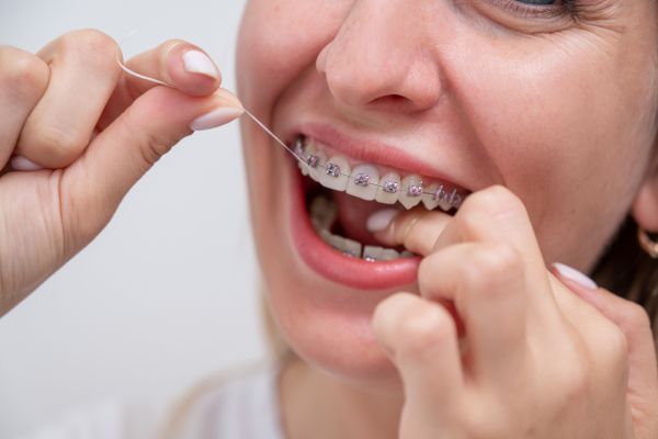 Invisalign Shrewsbury