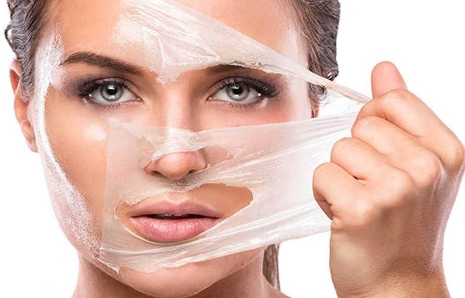 التقشير الكيميائي